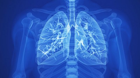 Bei einem Lungeninfarkt ist die Durchblutung des Lungengewebes vermindert oder gänzlich aufgehoben - Foto: iStock