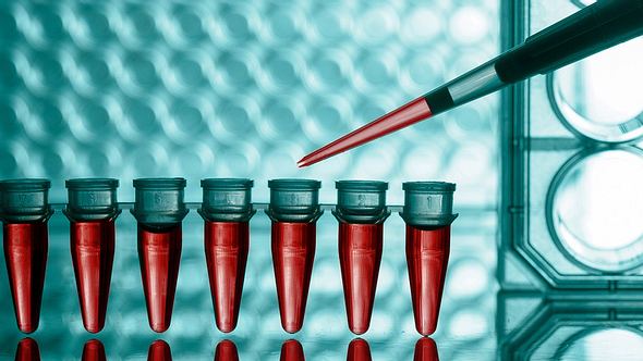 Mit speziellen Bluttests und Gewebeproben wird bei einer Autoimmunkrankheit das Auftreten von Abwehr-Zellen nachgewiesen, die sich gegen den eigenen Körper richten