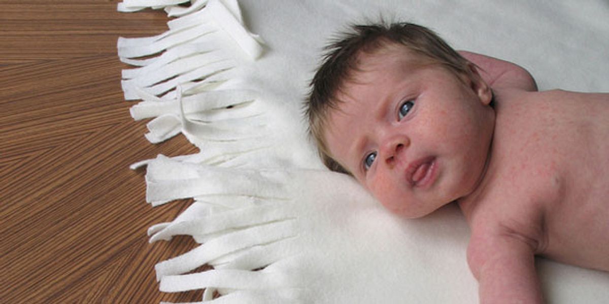 Baby mit Masern