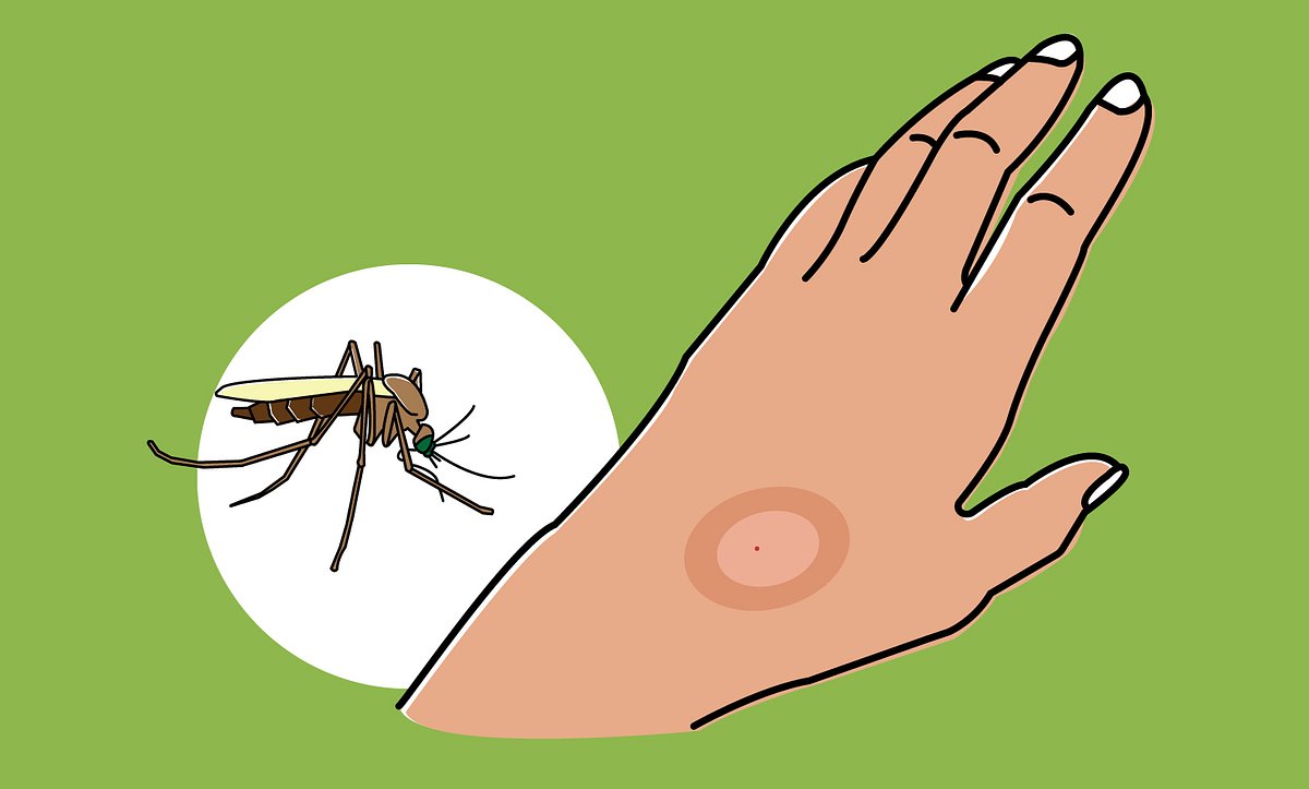 So erkennt man ein Mückenstich