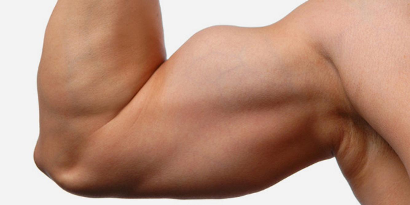 Muskelkater sind kleinste Muskelfaserrisse
