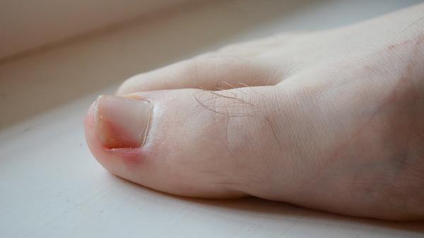 Foto: iStock - Foto: iStock Ilia Anatolev