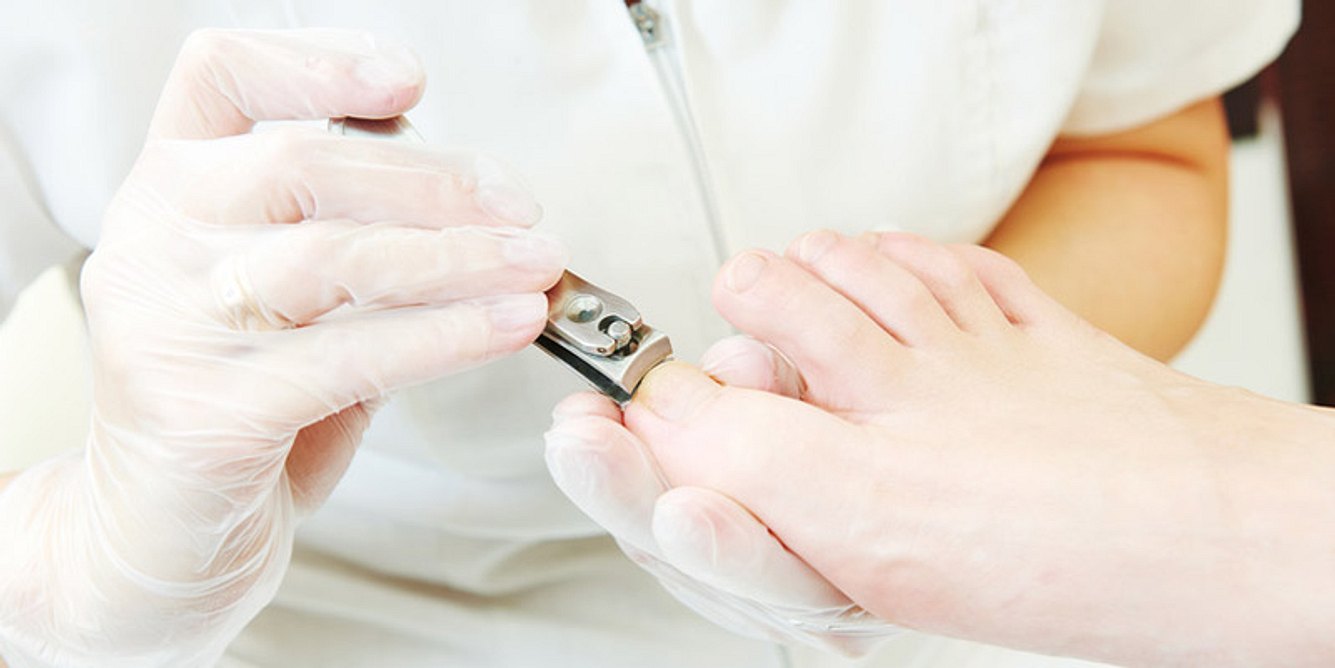 Medizinische Fußpflege bei Diabetikern kann Nagelpilz vorbeugen