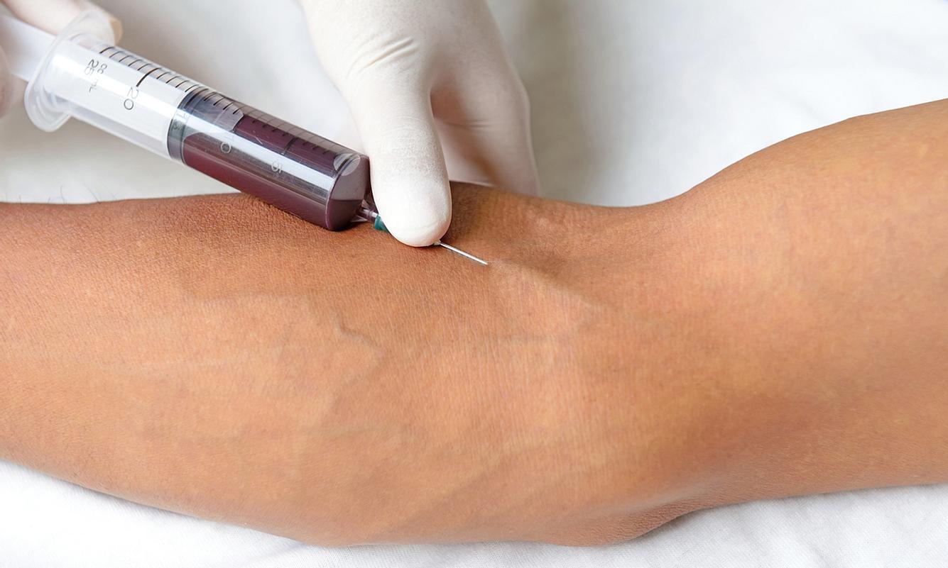 Blut abnehmen bei Narkolepsie