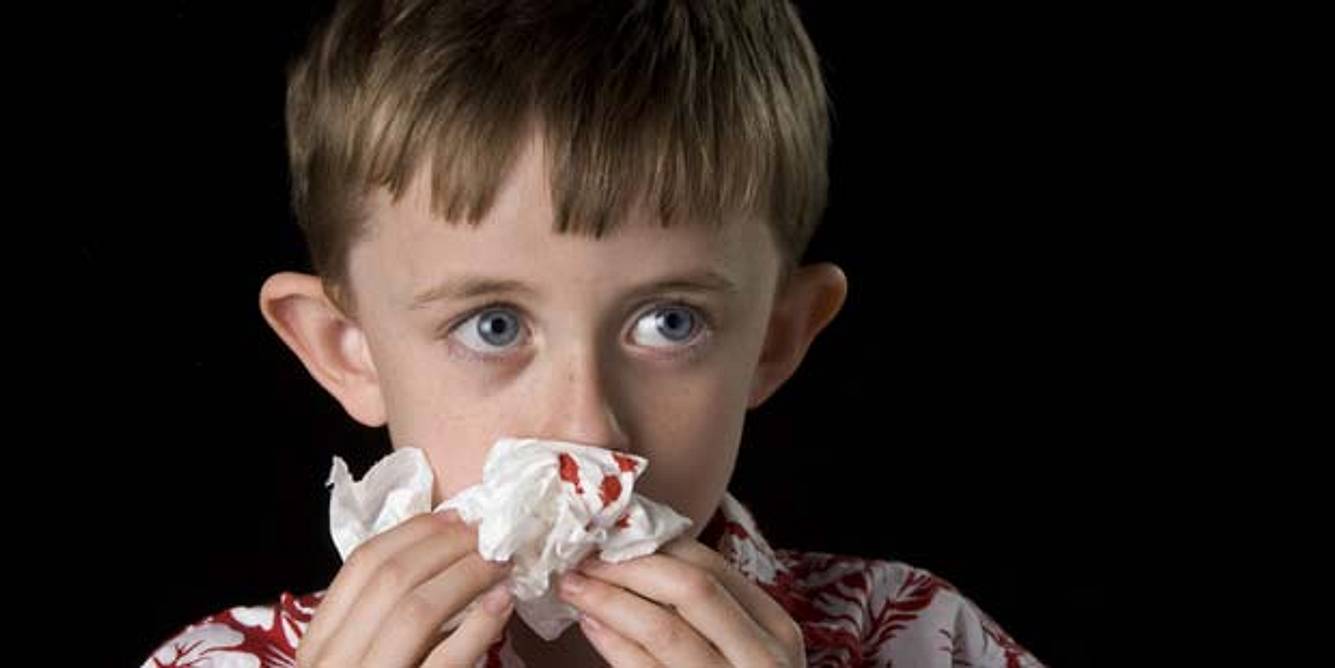 Nasenbluten beim Kind Symptom von ITP