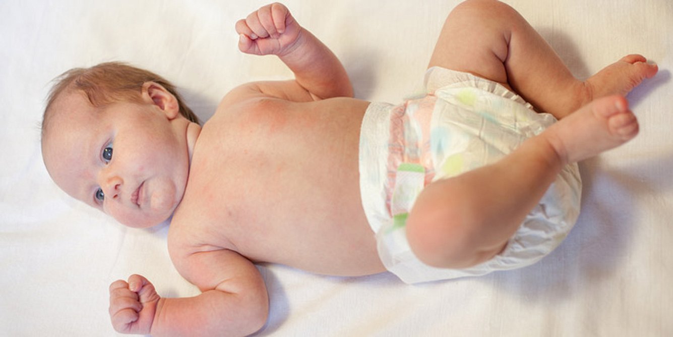 Baby mit kleinen Pickelchen