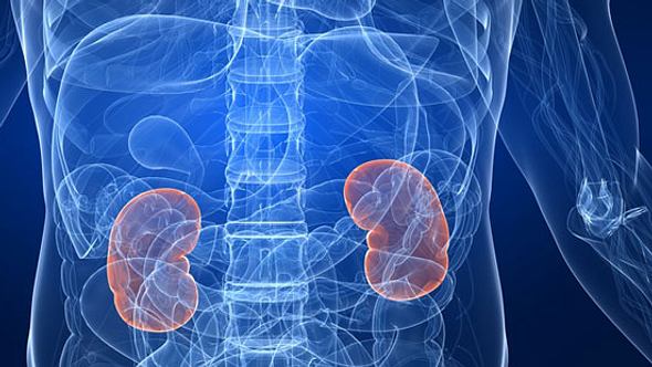 Was ist Nierenversagen und wie wird es behandelt?