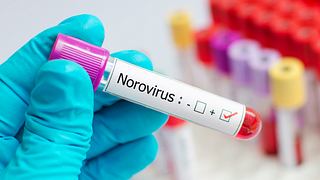 Positive Norovirus-Probe - Foto: iStock/jarun011