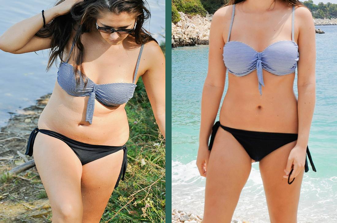 nulldiaet Vorher-Nachher-Bild einer Frau im Bikini