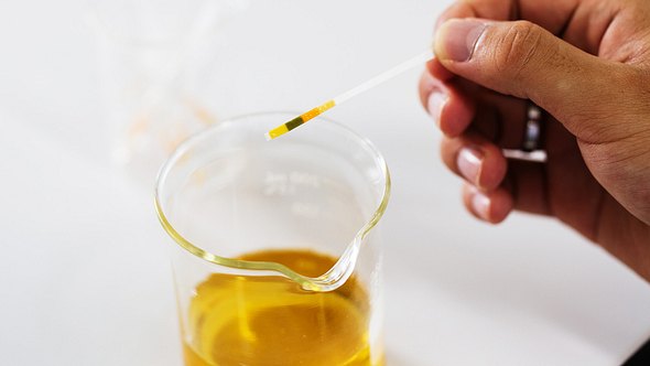 Urin in einem Glas wird mit einem Teststreifen untersucht - Foto: iStock-877408200 Sinhyu