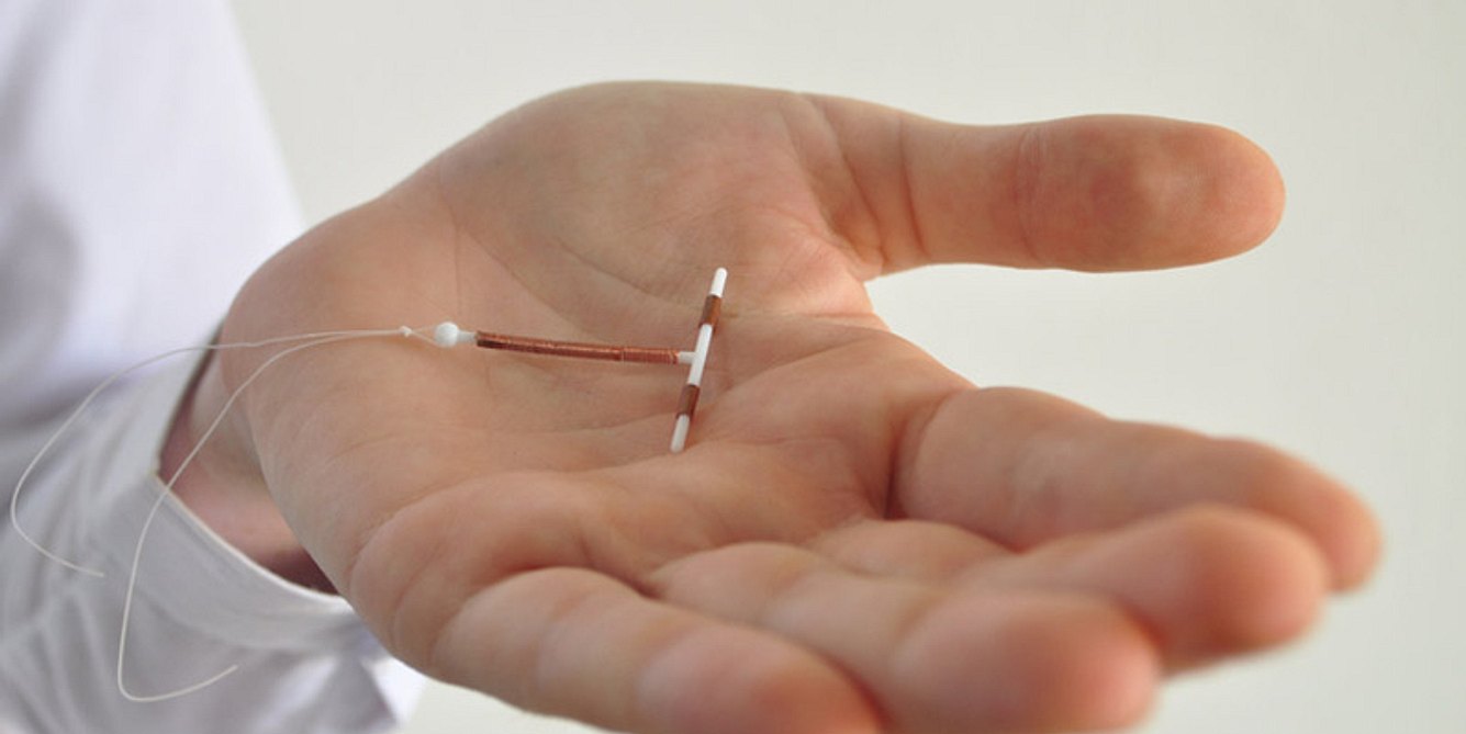 EIn Gynäkologe hält die Spirale danach in der Hand