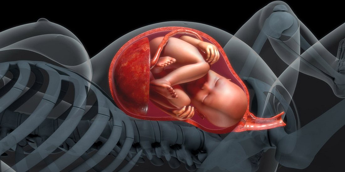 Schematische Darstellung einer Plazenta im Mutterleib