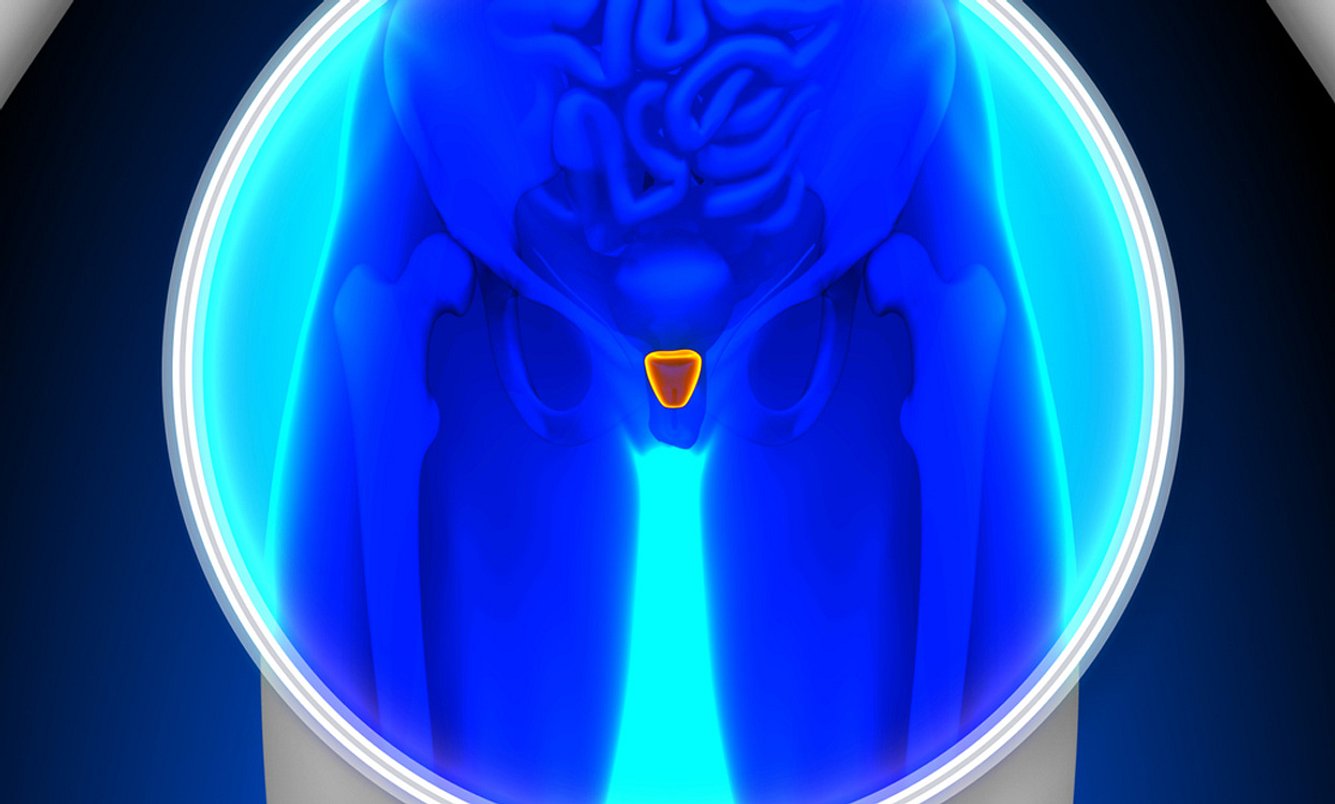 Prostata