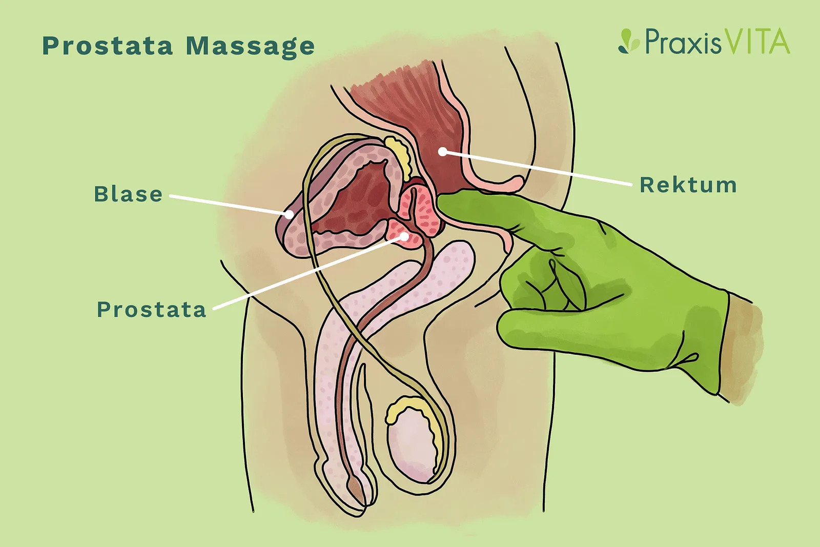 Masaje de prostata