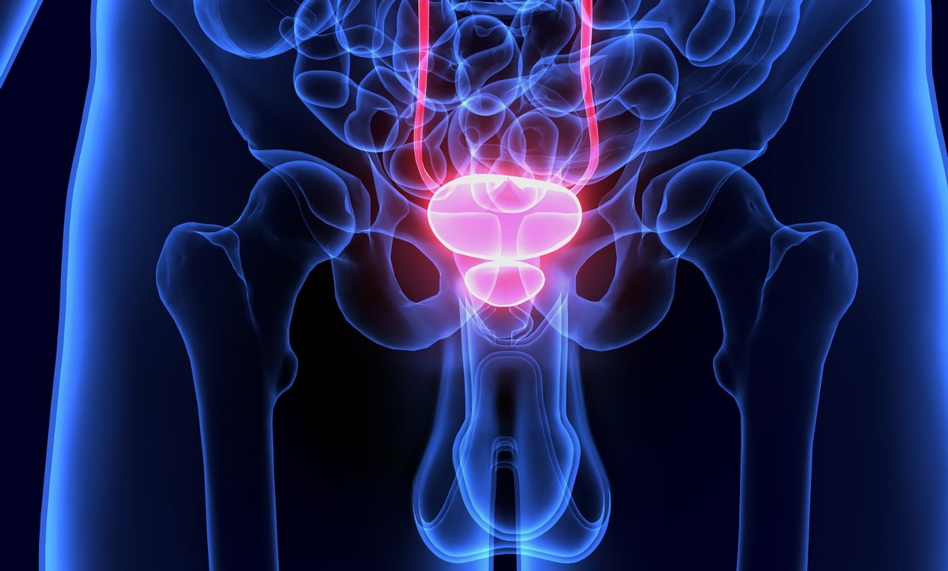 Prostatabeschwerden: Welche gibt es, wie werden sie behandelt?