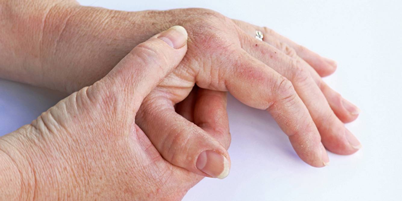 Psoriasis-Arthritis