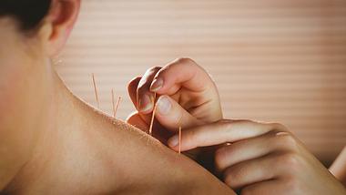 Akupunktur in der Schwangerschaft und zur Geburtsvorbereitung - Foto: iStock / Wavebreakmedia