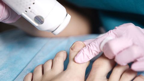 Zehn wichtige Fragen an den Dermatologen