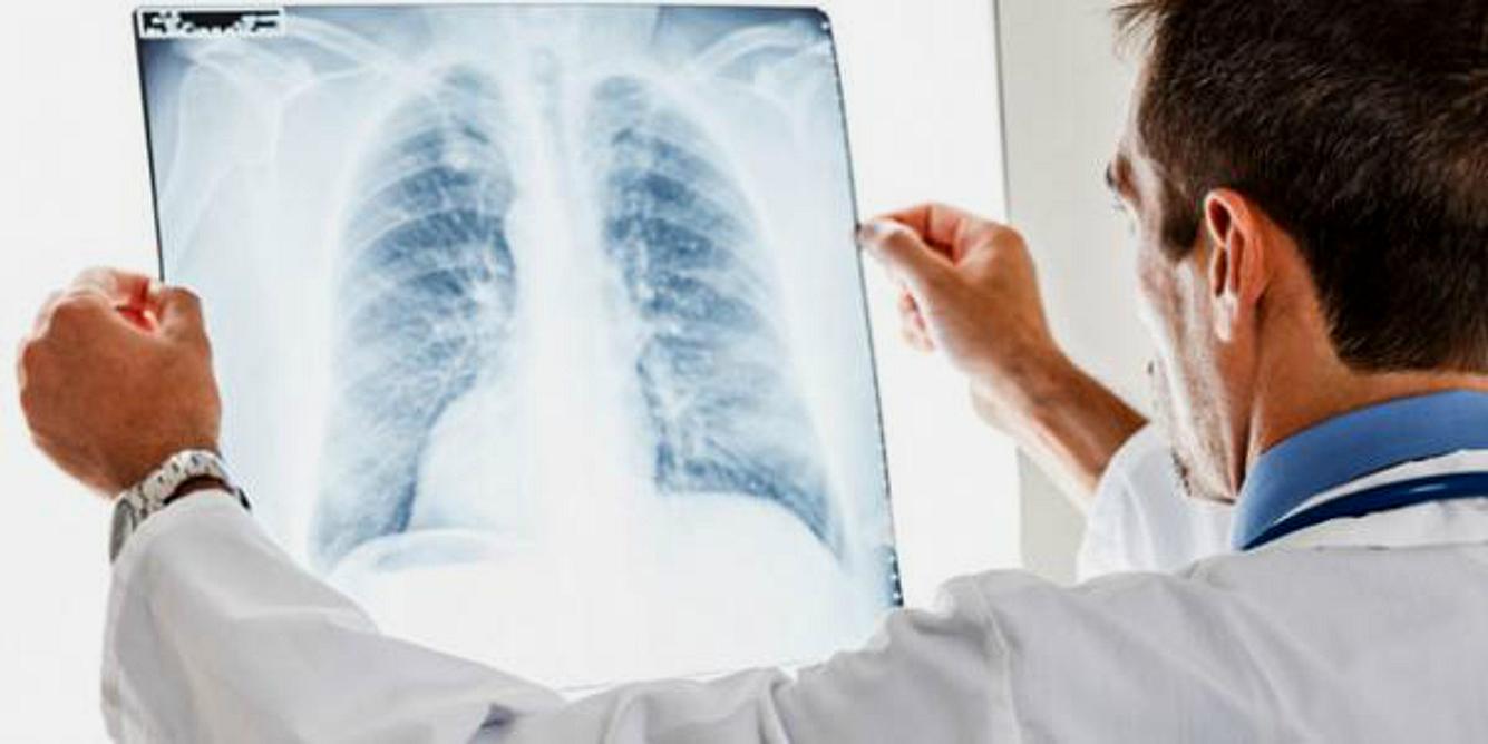 Der Arzt kann mit Hilfe eines Röntgenbildes und einer Blutabnahme schnell eine Lungenkrankheit erkennen