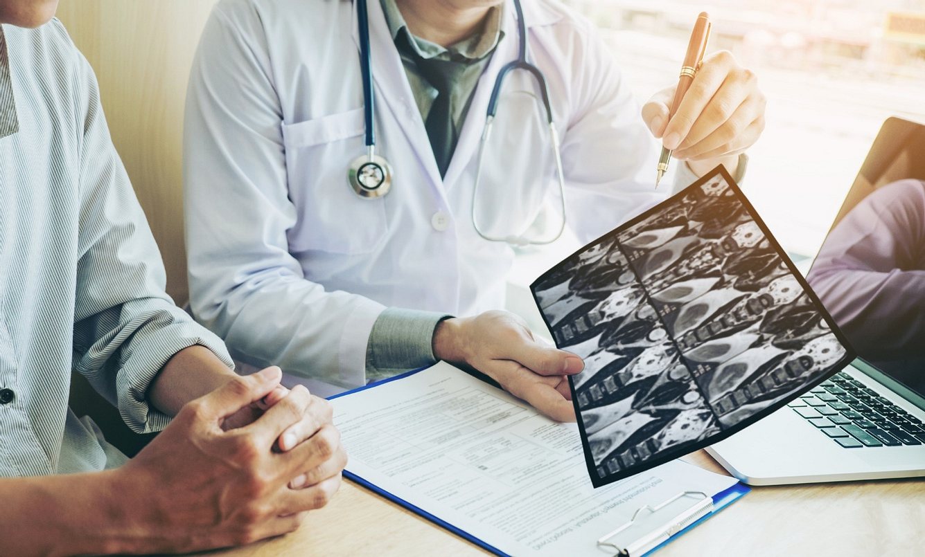 Röntgenaufnahmen sichern eine Lungenöden-Diagnose
