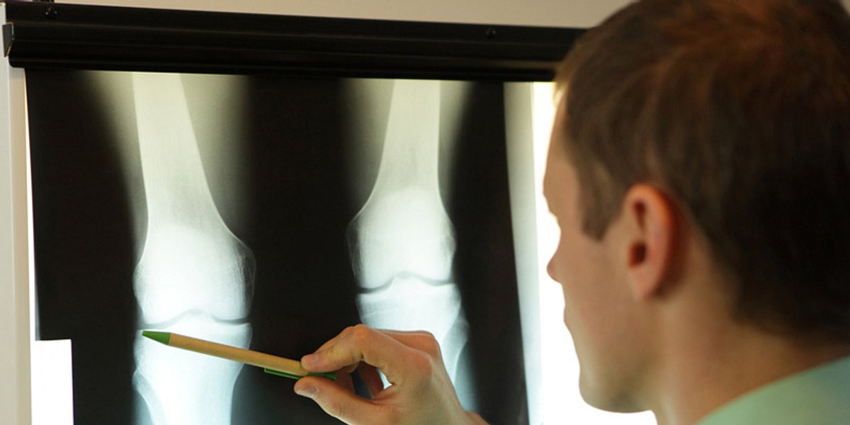 Röntgenbild für die Knieschmerzen-Diagnose
