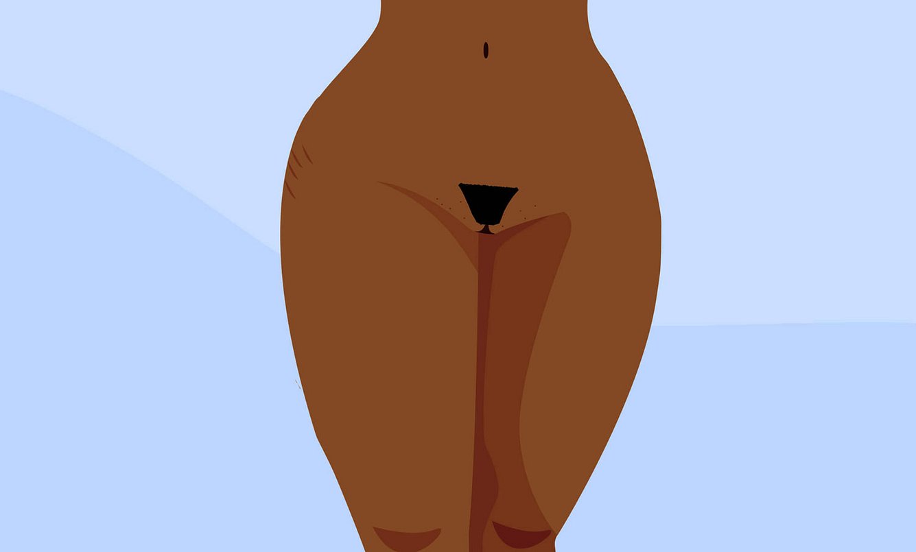 Schamhaarfrisur Bikini-Cut