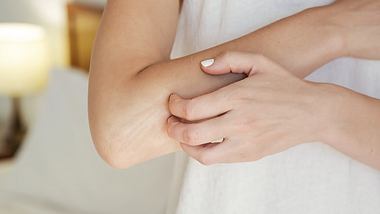 Frau kratzt sich am Arm - Foto: istock/triocean