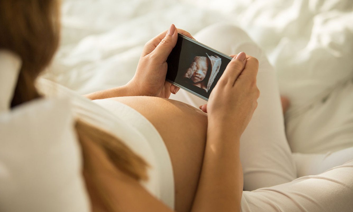 Schwangere schaut sich §D Ultraschallbild an