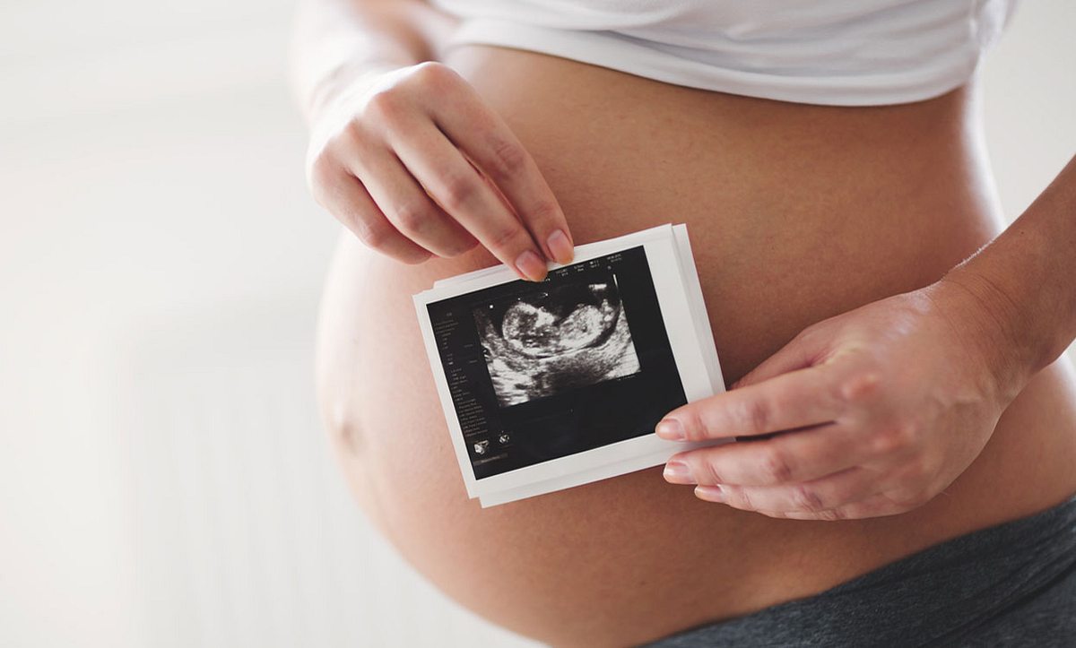 Schwangere Frau hält sich Ultraschallbild vor den Bauch