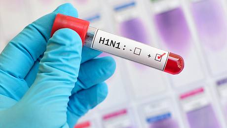 Ein Labormitarbeiter hält eine Probe mit dem H1N1-Virus in der Hand - Foto: istock_jarun011