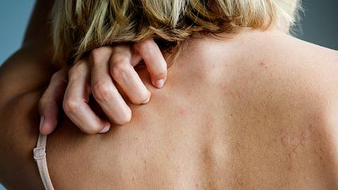 Eine Frau kratzt sich am Rücken - Foto: iStock/Rawpixel