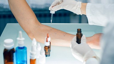 Prick-Test auf dem Arm eines Patienten - Foto: iStock/bluecinema