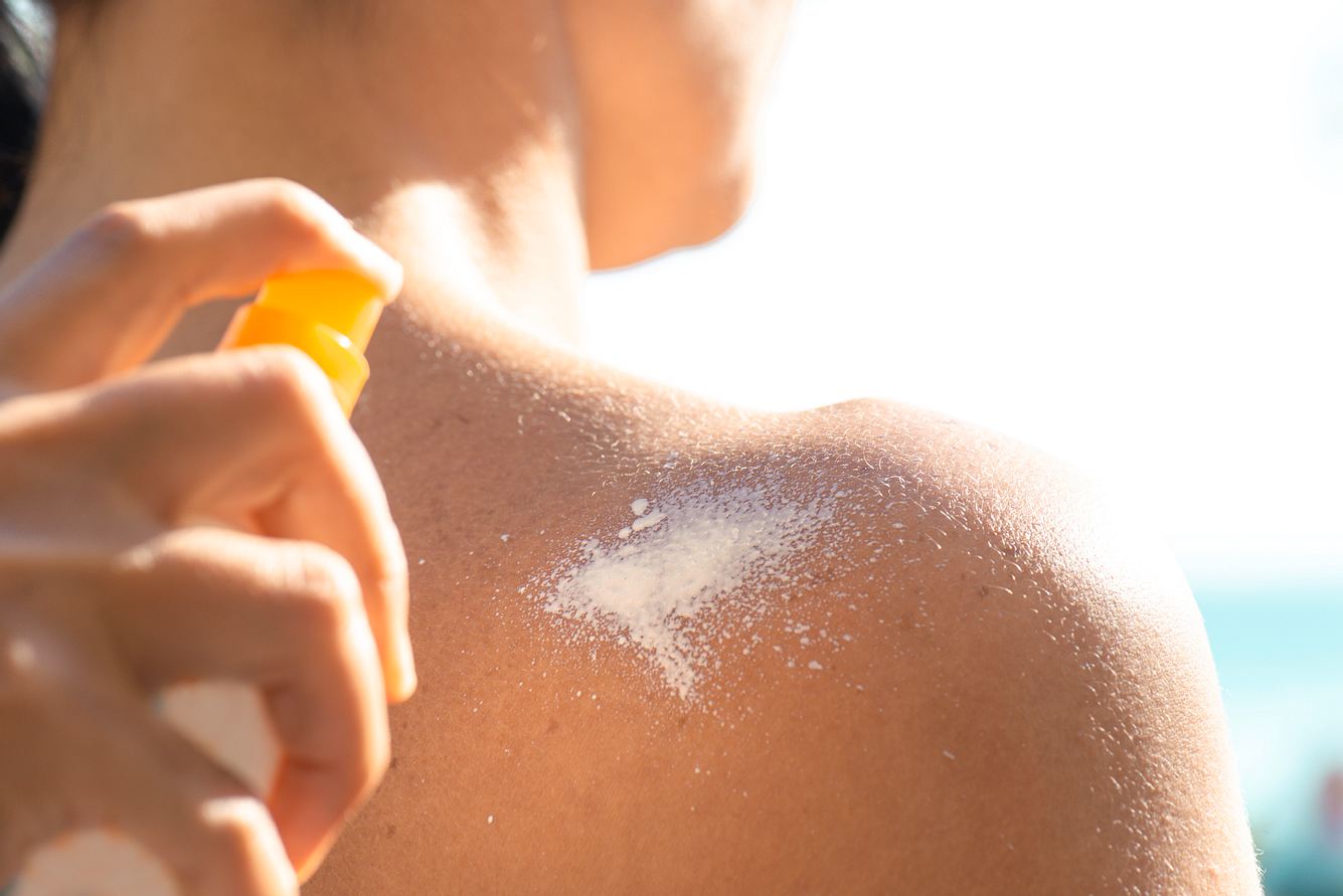 Frau sprüht Sonnencreme auf die Schulter als Sonnenschutz der Haut
