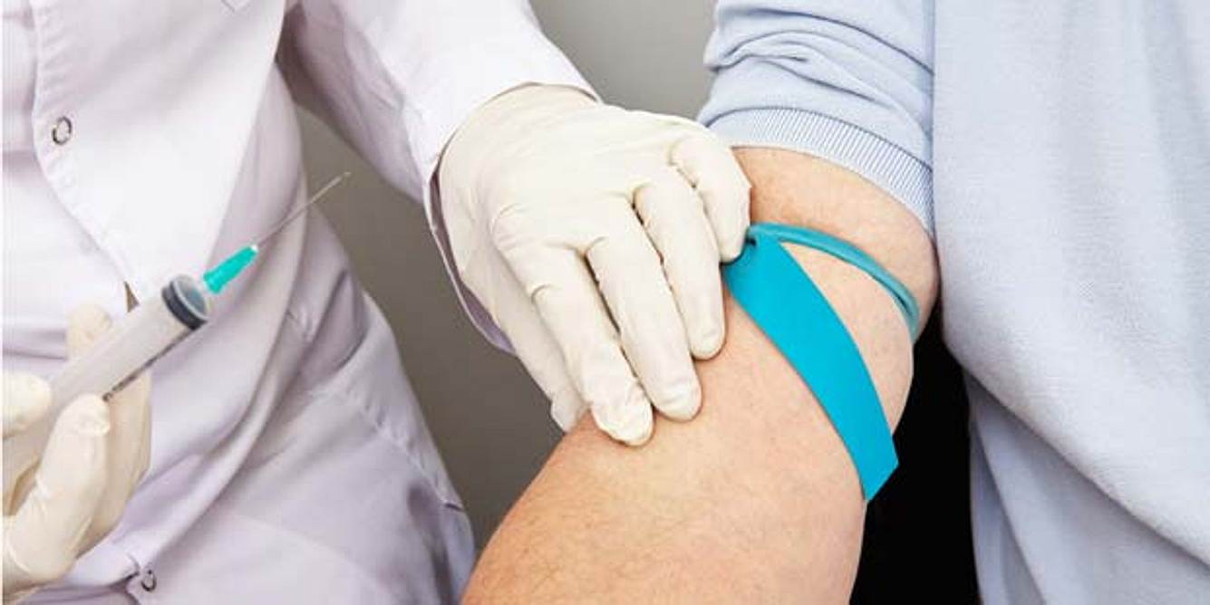 Steatosis-hepatis-Diagnose Blutuntersuchung Leberwerte