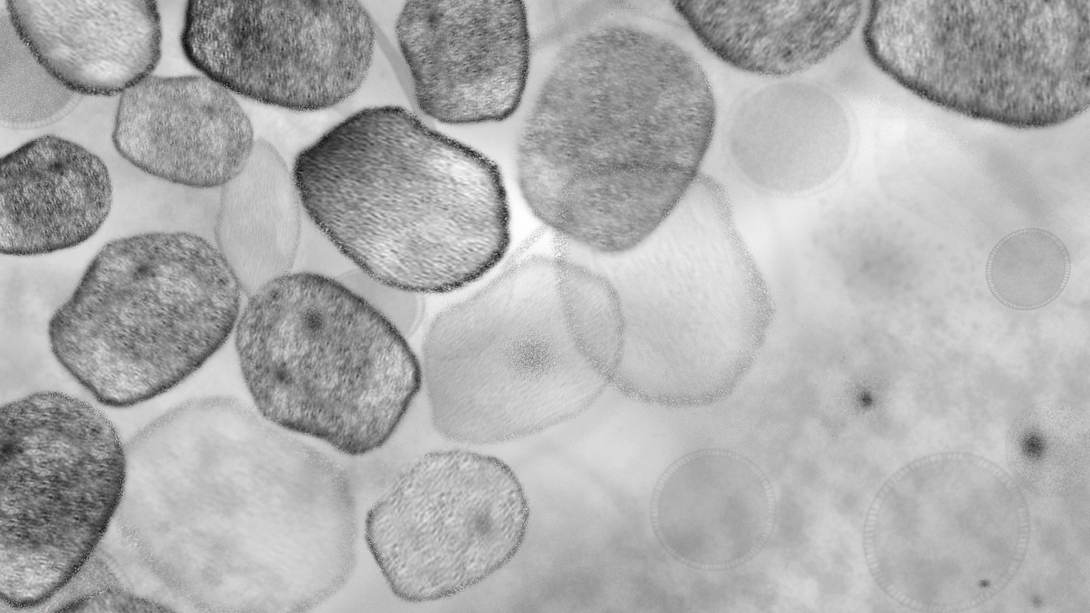 Affenpocken-Erreger unter dem Mikroskop - Foto: IMAGO/Westlight