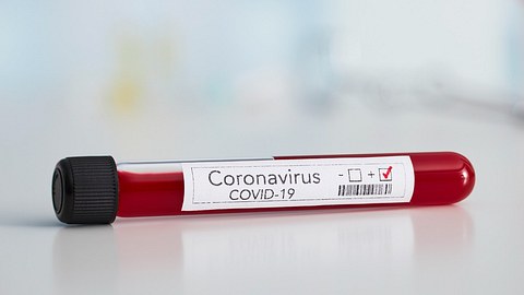Eine Blutprobe mit positivem Corona-Testergebnis - Foto: iStock_bombuscreative
