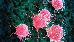 Krebszellen - Foto: iStock/nopparit