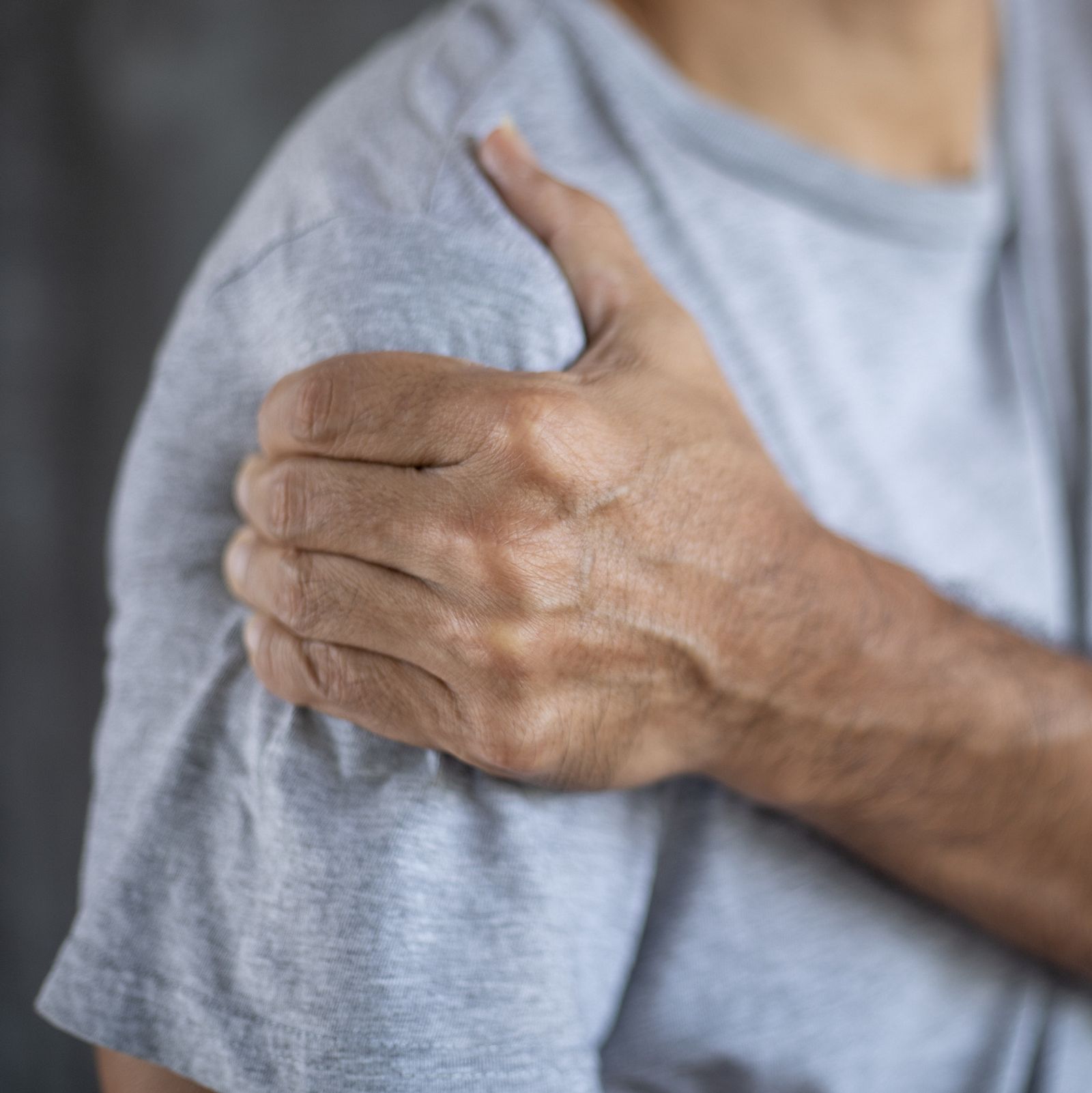 View 15 Thrombose Handgelenk Bilder imageplaybox