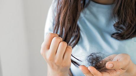 Frau hält ein Büschel Haare in der Hand - Foto: iStock/Rattankun Thongbun