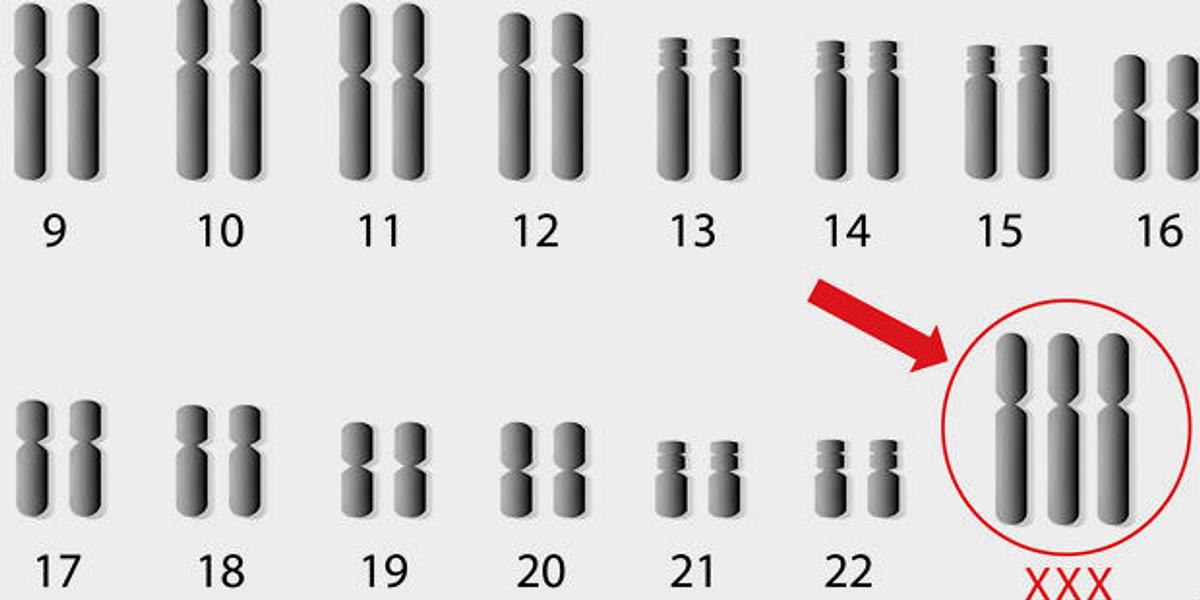 Trisomien gehören zur Gruppe der Chromosomenanomalien