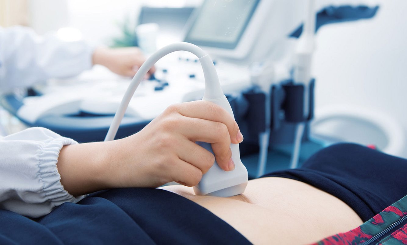 Ultraschall durch die Bauchdecke beim Frauenarzt zur Diagnose von Eierstockkrebs
