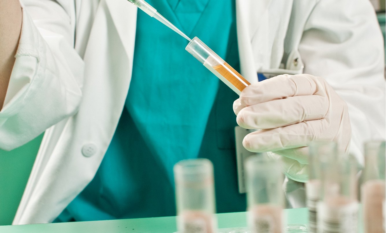 Bei einer Harnröhrenentzündung sichert eine Urinprobe die Diagnose
