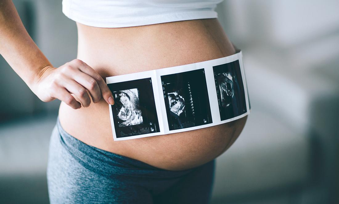 utraschall-baby Ultraschall Schwangerschaft