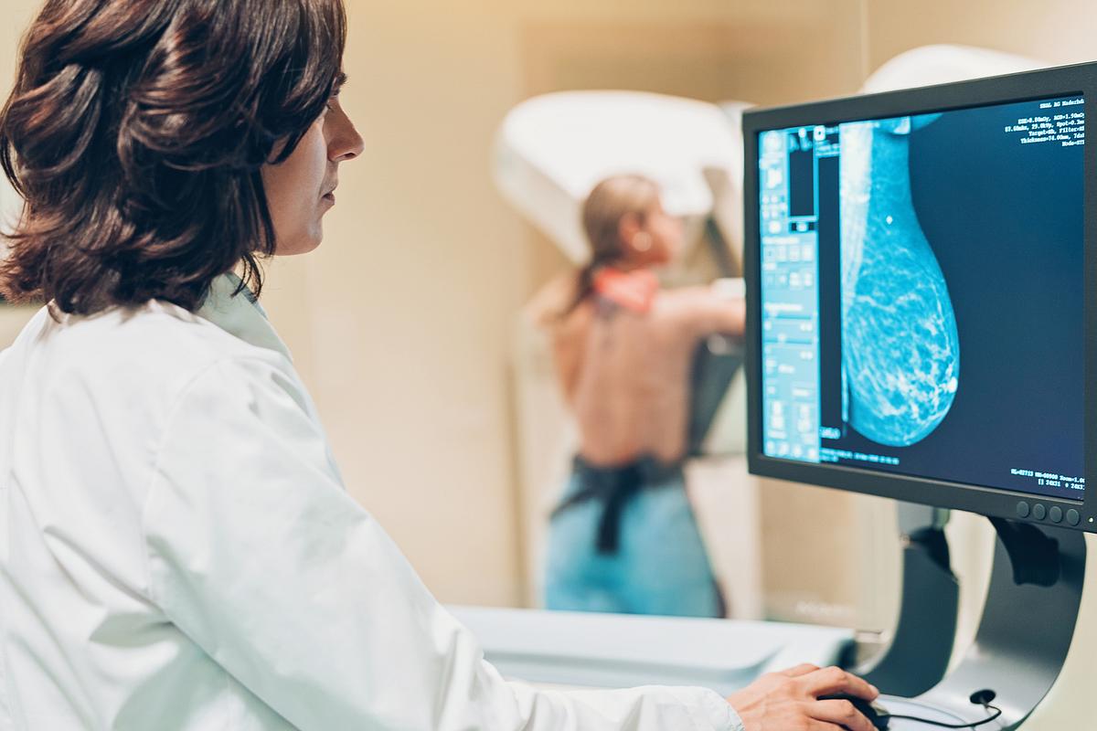 Eine Frau bei der Mammographie