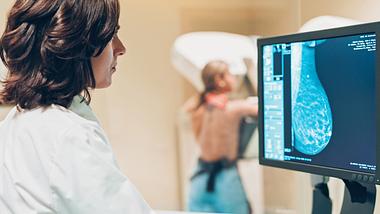 Eine Frau bei der Mammographie - Foto: iStock/pixelfit