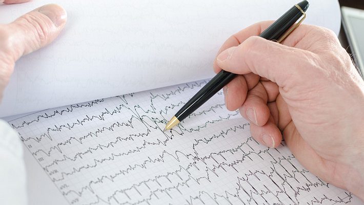 Vorhofflimmern – Ursachen und Risikofaktoren