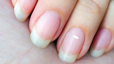 Eine Nahaufnahme von Fingernägeln, wobei auf einem Nagel ein weißer Fleck zu sehen ist - Foto: IStock_Images we create