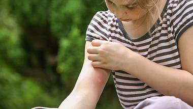 Ein Kind hat einen Stich am Arm - Foto: iStock/dorioconnell