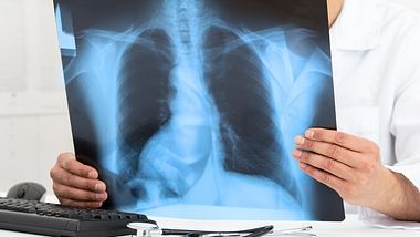 Arzt hält Röntgenbild in der Hand - Foto: Istock/Cunaplus_M.Faba
