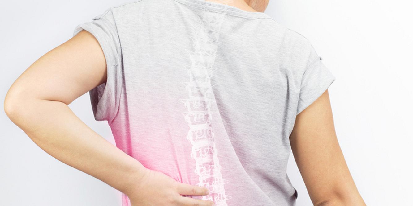 Spondylitis ankylosans
